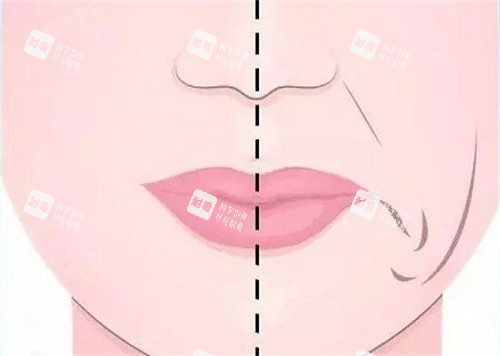 口周年轻化前后对比 口周年轻化前后对比