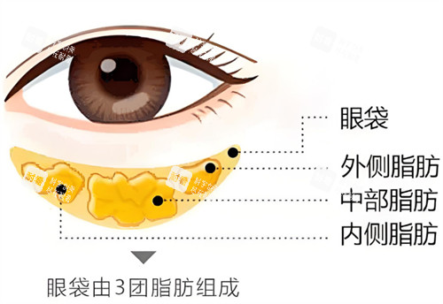 眼袋构成