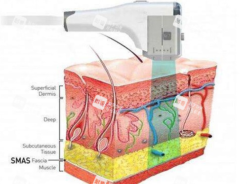 超声仪器示意图 超声仪器示意图