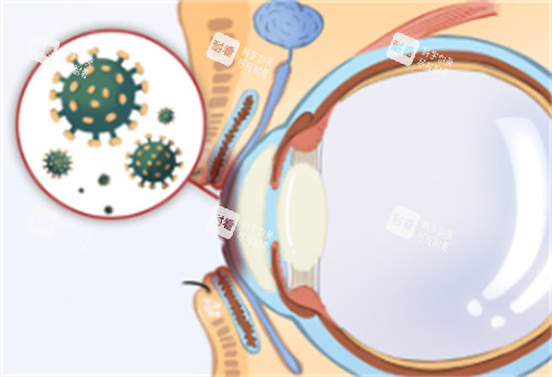 角膜炎治疗方式