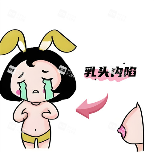 乳头内陷动画图