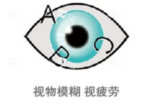 视物模糊 视疲劳