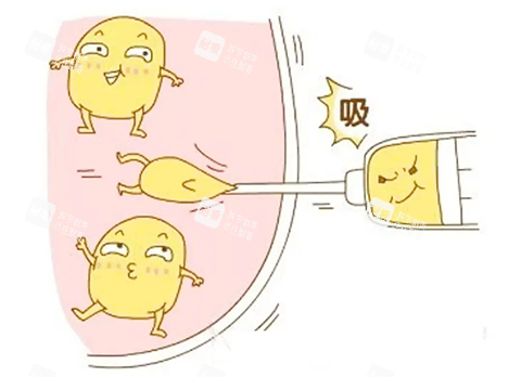 吸脂生动卡通图