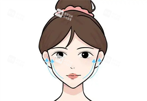 面部提升卡通图展示