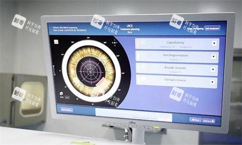 飞秒激光白内障