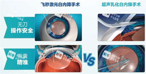 飞秒激光白内障手术和超声乳化白内障手术区别