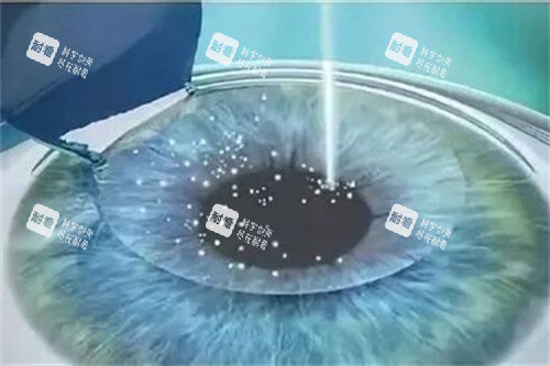 成都成华区眼科医院排名前三：新视界/小青草/普瑞眼科口碑与预约挂号指南！