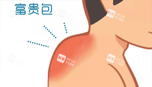 富贵包动画展示