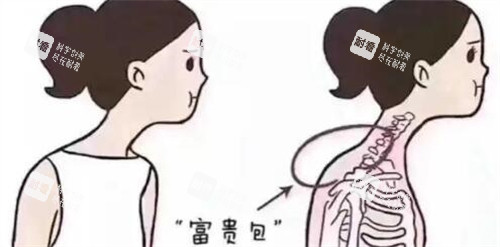 脖子富贵包卡通图展示照片