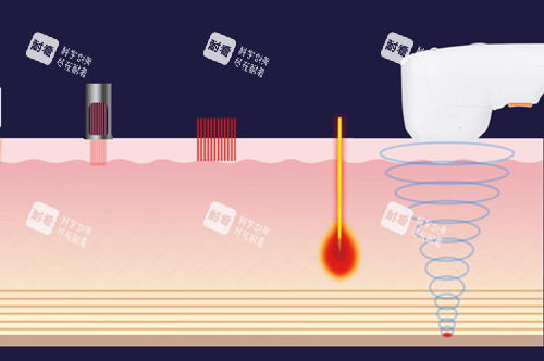 不同光电项目作用层次示意图