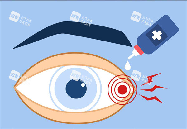 眼睛敏感卡通图