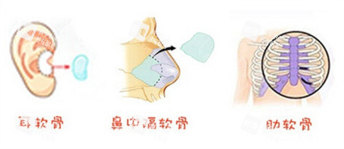 自体组织 自体组织