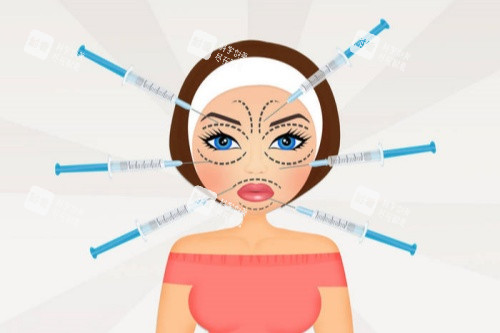 面部注射玻尿酸卡通图