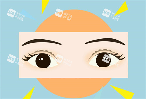 上海时光整形美容医院是正规的吗？余东、徐怀河眼整形手术实例给你答案！