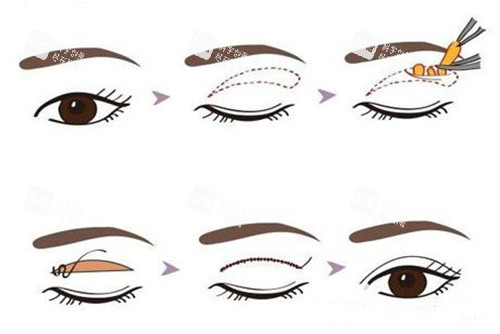 曲靖韩美医疗美容门诊部口碑好不好？服务贴心结果佳，当地口碑稳定靠谱