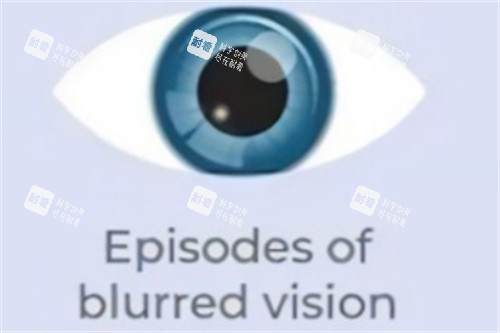 视力模糊发作