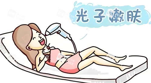 光子嫩肤图
