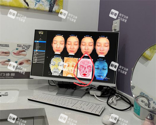 北京三仁医美的面部检前后对比