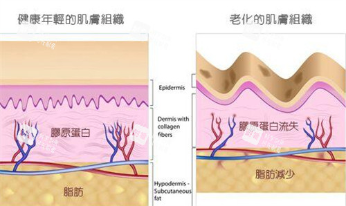 注射童颜针前后对比