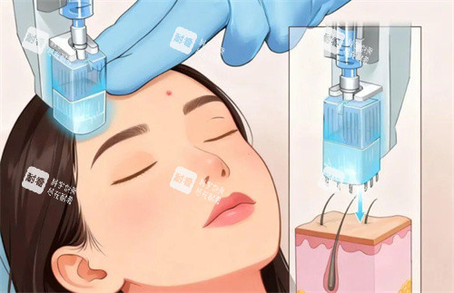 热玛吉操作卡通图片