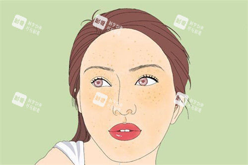 黄褐斑图片展示