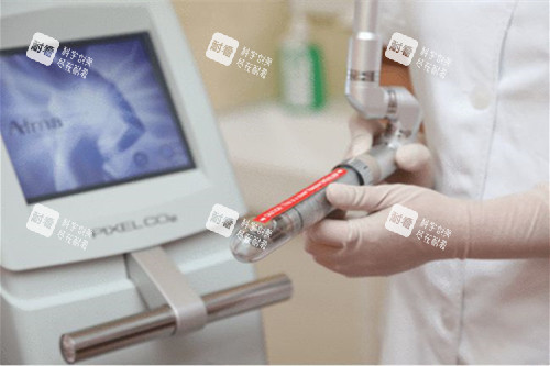 激光缩阴 激光缩阴