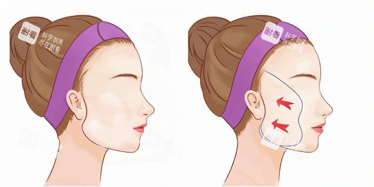 武汉诠美医生医疗美容怎么样？专注拉皮与脂肪项目多年，双眼皮隆胸关注度解析！