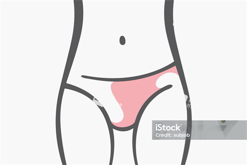 马甲线吸脂 马甲线吸脂