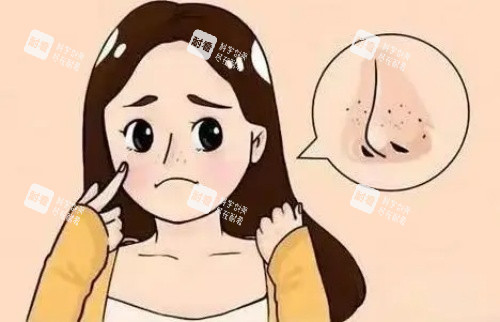 酒糟鼻状态示意图