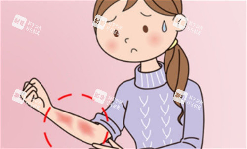 祛疤手术 祛疤手术