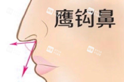 鹰钩鼻卡通图 鹰钩鼻卡通图