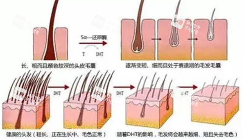 毛囊的不同健康情况 毛囊的不同健康情况