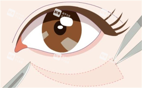 徐州二院整形美容科怎么样?省级重点专科坐镇,金培生/张爱君领衔打造自然美学!