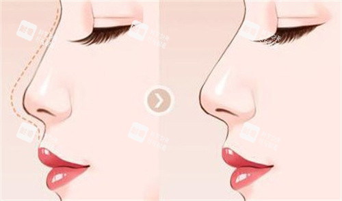 想做微整、眼部鼻部整形、脂肪填充植发？金华永康臻蓉颜医疗美容别错过！