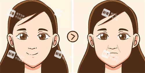 祛法令纹前后对比卡通图