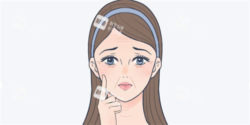 法令纹动画展示图