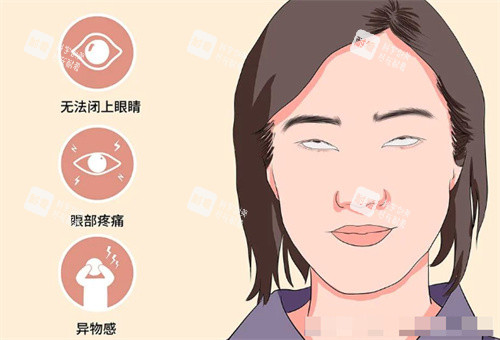 需要做眼修复的情况