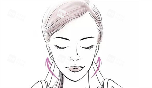 提升手术 提升手术