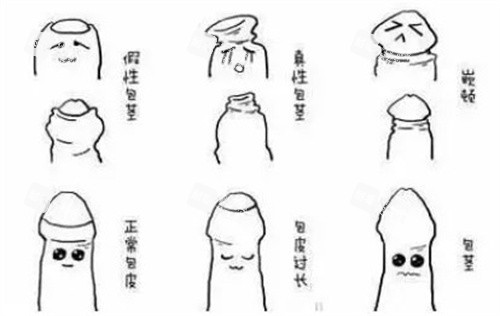 包皮的类型