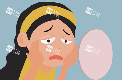 双眼皮松弛 双眼皮松弛