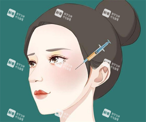 面部注射动画图片