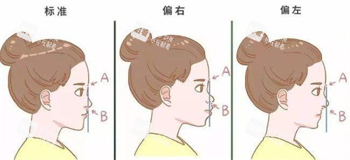 鼻基底不同情况