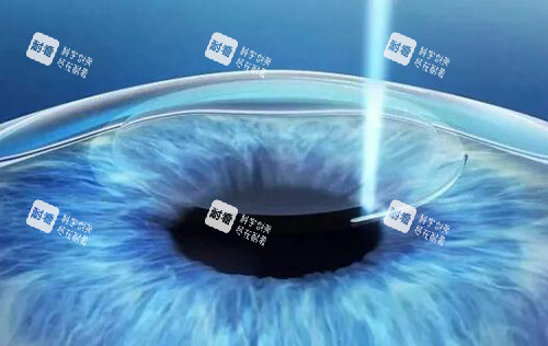 飞秒激光展示图 飞秒激光展示图