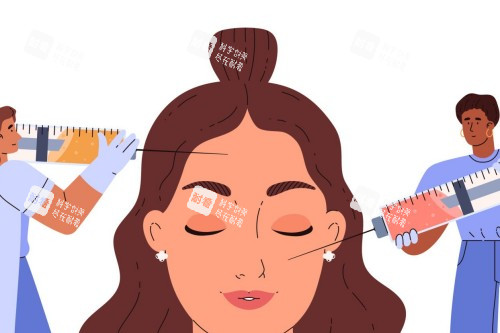 面部注射卡通示意展示 面部注射卡通示意展示