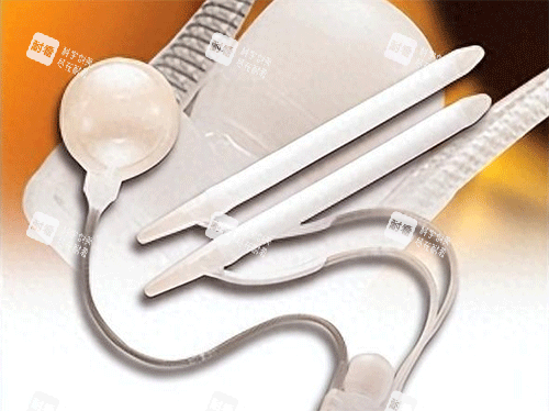 男性阴茎假体植入手术