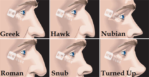 不同类型需要矫正的鼻子