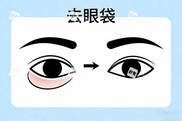 祛除眼袋前后对比图 祛除眼袋前后对比图