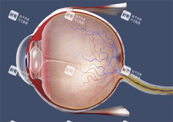 黄斑兜带术动画图