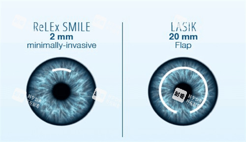 山西省眼科医院做近视眼手术多少钱?收费标准:半飞秒9900元起、全飞秒15000元起、ICL晶体植入2.9万元起