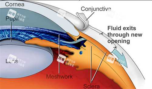 青光眼出现问题的部位